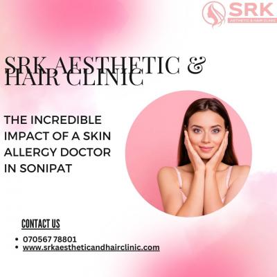 Skin Allergy Doctor in Sonipat