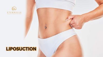 Liposuction In Hyderabad | Eternelle Aesthetics - Bangalore Health, Personal Trainer