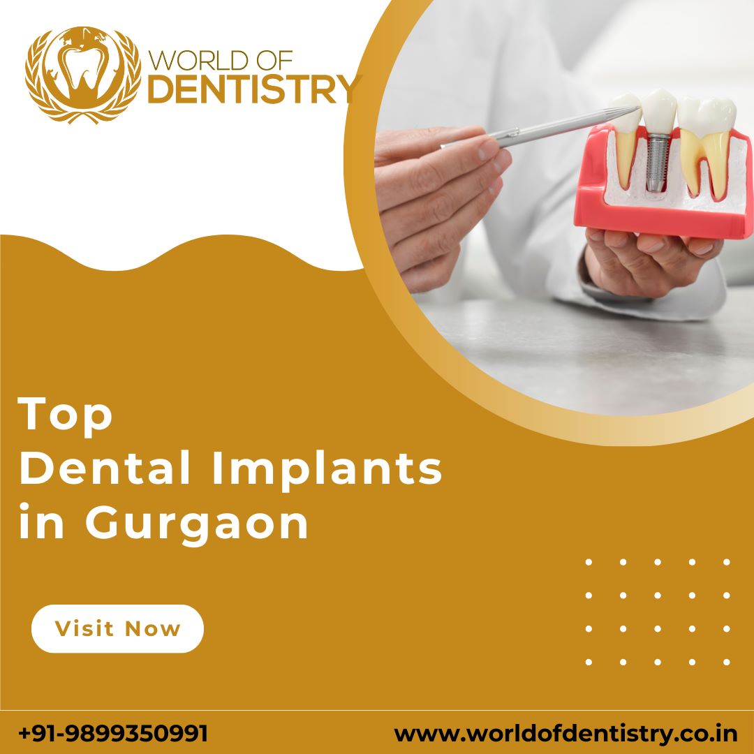 Get the Best Dental Implants in Gurgaon - Gurgaon Other