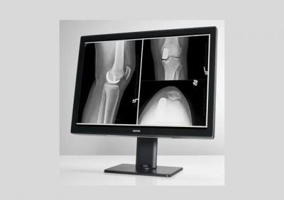 Elevate Radiology Practice with Barco's Premium Display Solutions - Other Other