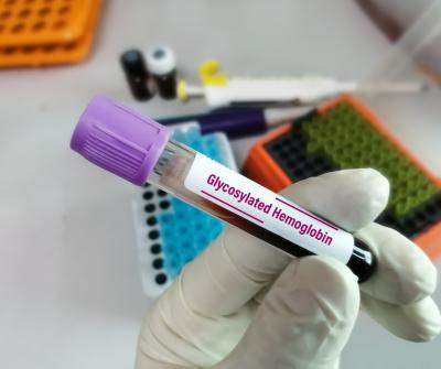 Glycosylated Hemoglobin Test at Agilus Diagnostics - Pune Health, Personal Trainer