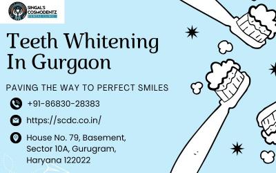 Expert Teeth Whitening in Gurgaon | Dr. Ishant Singal - Gurgaon Health, Personal Trainer