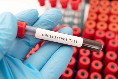 Qris Health Provides Cholesterol Lipid Profile Test in - Delhi Health, Personal Trainer