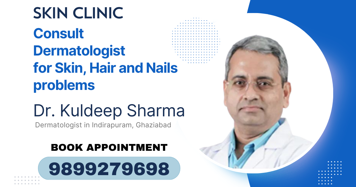 Best Dermatologist (Skin Doctor) in Indirapuram, Ghaziabad  - Ghaziabad Other