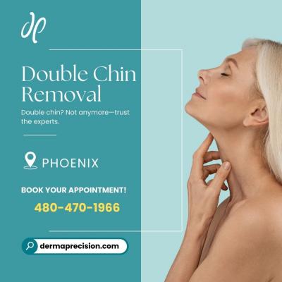 Double Chin Removal in Phoenix - Phoenix Other