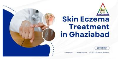Skin Eczema Treatment in Ghaziabad - AL - Rehmat
