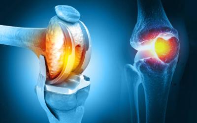 Knee Replacement Surgery | Maddagar Foundation - Faridabad Other