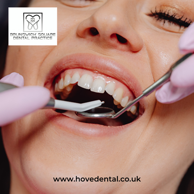 Treatments dental hygiene in Hove