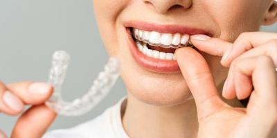 Top Orthodontist Abu Dhabi | Quality Dental braces Abu Dhabi