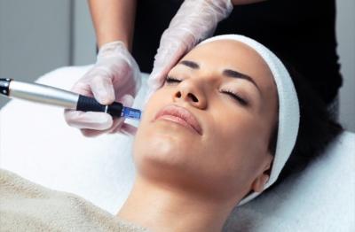 Rejuvenate Your Skin with Exosomes Microneedling Treatment