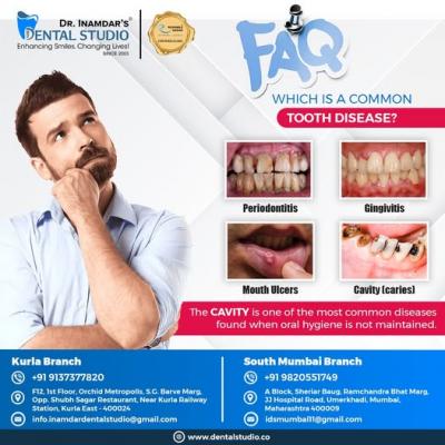Tooth filling treatment Kurla - Sydney Other