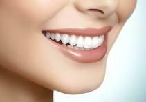 Teeth whitening in Abudhabi