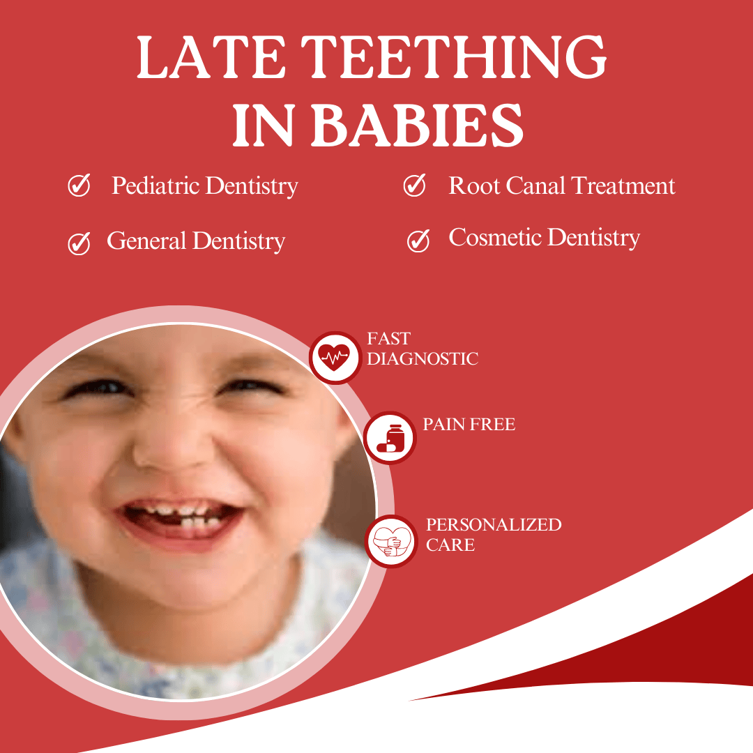 late teething in babies - Dubai Professional Services