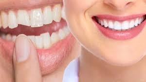 Cosmetic Dental Treatments In AL KHAJA MEDICAL CENTER Abu Dhabi.