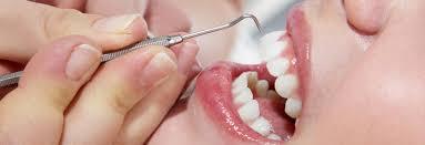 Tooth extraction in Abu dhabi