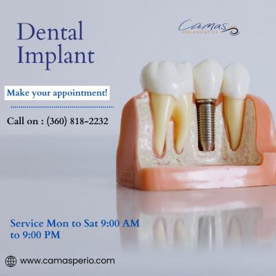 Who Provides the Best and Most Affordable Dental Implants in Camas, WA?