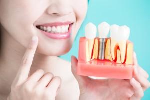 Cosmetic Dentistry in Buford