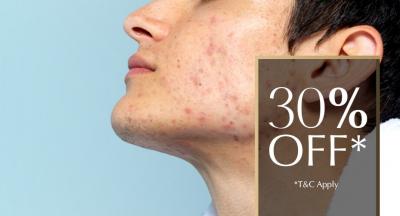 Laser Treatment for Acne & Acne Scar Removal in Santacruz West & Khar West | Kosmoderma