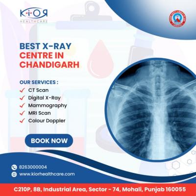 Best x-ray centre in Chandigarh
