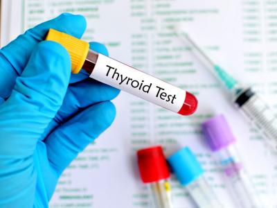Thyroid Profile Test Price