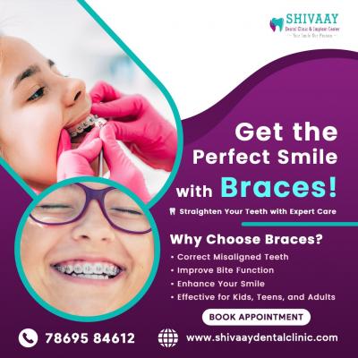 Braces & Aligners in Indore  - Indore Other