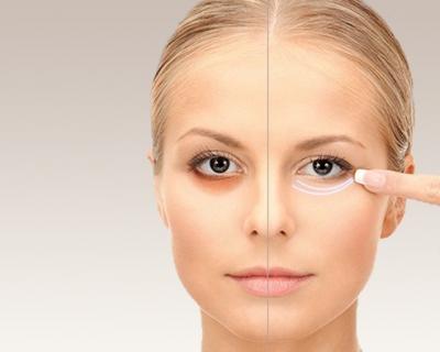Eye Bags Removal Treatment in Santacruz West | Get Youthful, Refreshed Eyes
