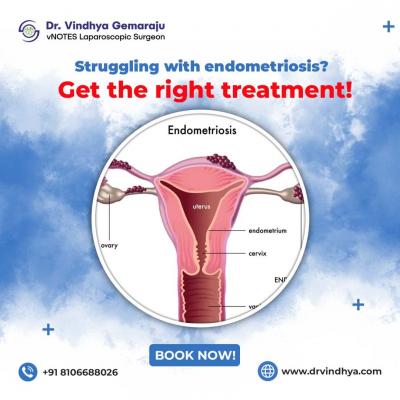 Best Endometriosis Treatment In Hyderabad | Dr. Vindhya Gemaraju