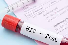 HIV testing Dubai