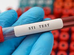 Sti testing Dubai