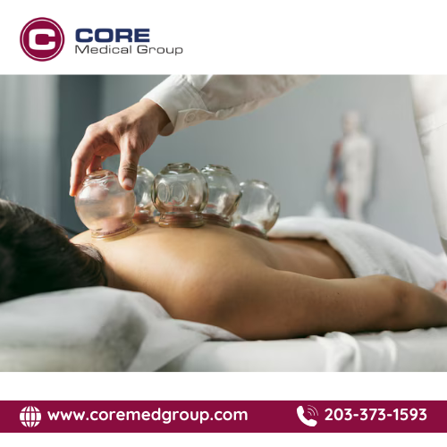 Acupuncture Therapy in Connecticut - Other Health, Personal Trainer