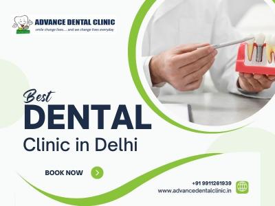 Best Dental Clinic in Delhi - Advance Dental Clinic