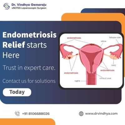 Best Endometriosis Treatment in Hyderabad – Consult Dr. Vindhya Gemaraju Today!