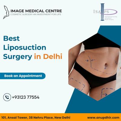 Best Liposuction Surgery in Delhi