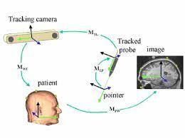 How Image Guided Surgery Enhances Surgical Accuracy