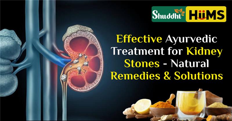 Ayurvedic Treatment for Kidney Stone – Natural Remedies & Solutions
