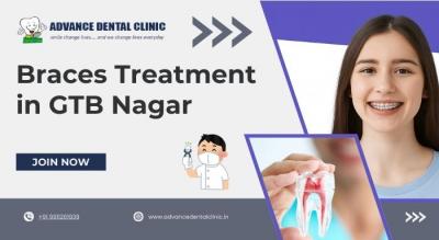 Braces Treatment in GTB Nagar - Advance Dental Clinic