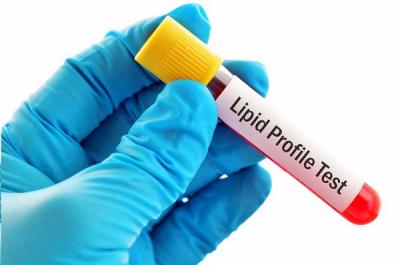 Lipid Profile Blood Test