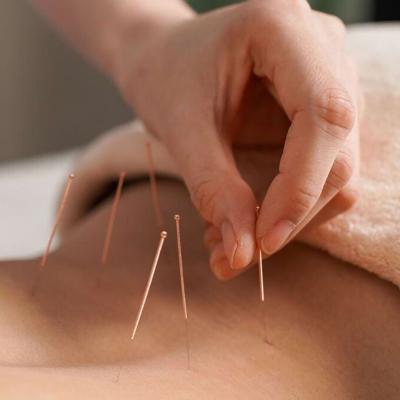 Acupuncture Trigger Point Therapy