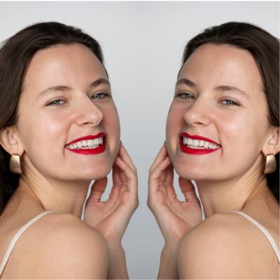 Forma skin tightening before and after