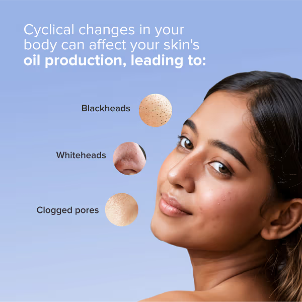 Nose Strip - Mumbai Other