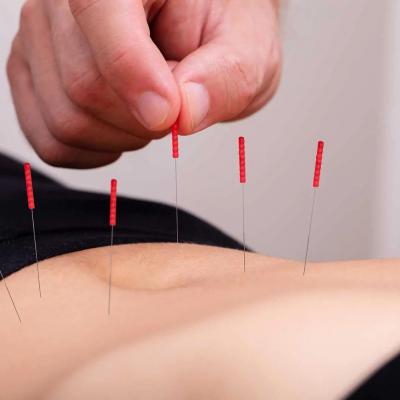 Acupuncture Treatment For Anxiety - San Francisco Other