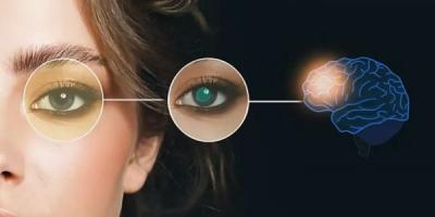 Best Neuro Ophthalmology Hospital in Gurgaon - Gurgaon Other