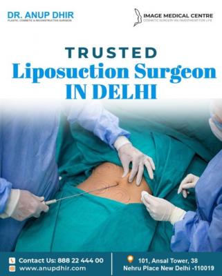 Trusted Liposuction Surgeon In Delhi – Dr. Anup Dhir