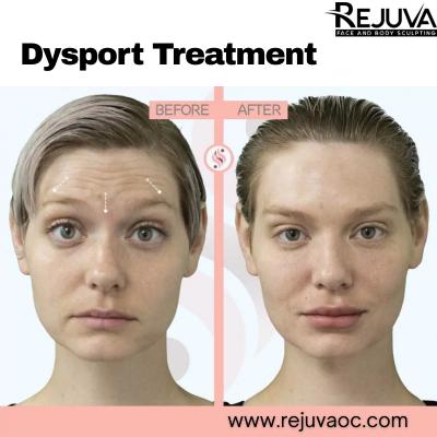 Dysport Treatment in Newport Beach
