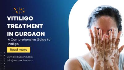 Get Vitiligo Treatment in Gurgaon At Estique Clinic