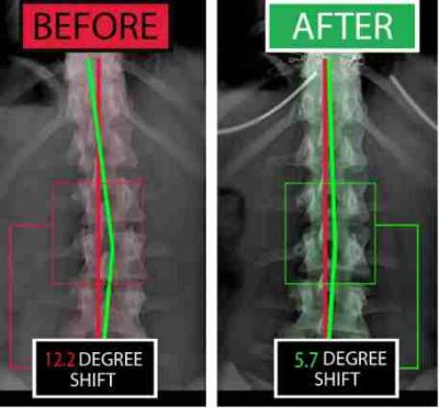 Massage Therapy Columbus OH - Other Other