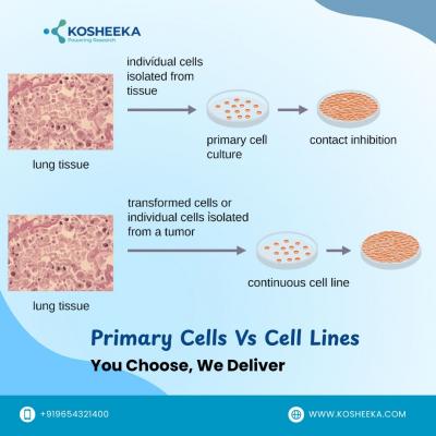 Primary Cells Vs Cell Lines: You Choose, We Deliver