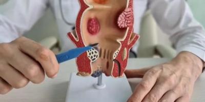 Proctologist in Gurgaon – Gutwell Clinic - Gurgaon Other