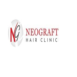 Chandigarh Hair Transplant - Chandigarh Other