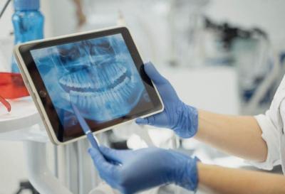 Root Canals Treatment - San Diego Health, Personal Trainer